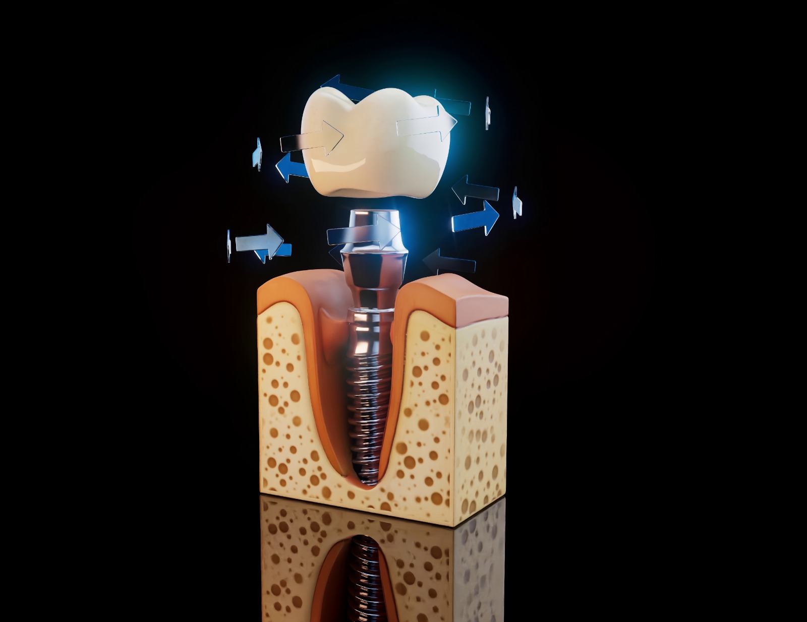 Un Zambet — implant dentar la 300€, Pacurari Iasi, programari 0793 400 300